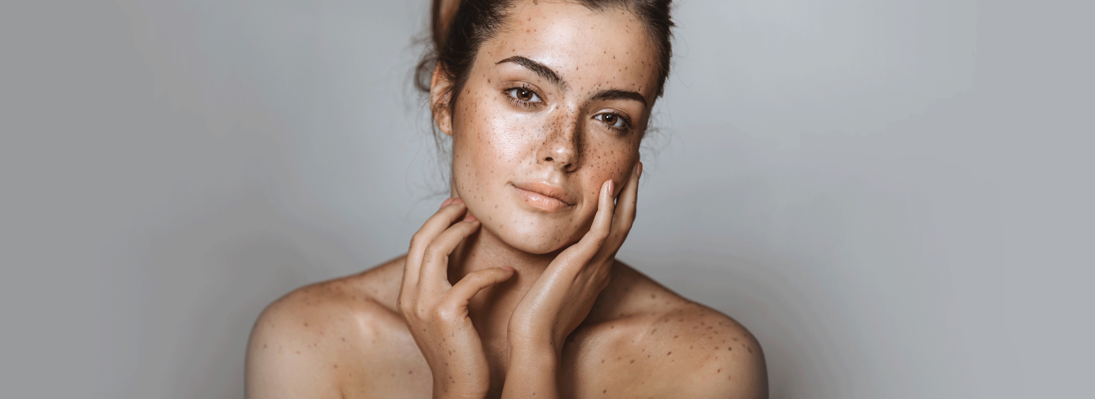 laser treatment strawberry lift review