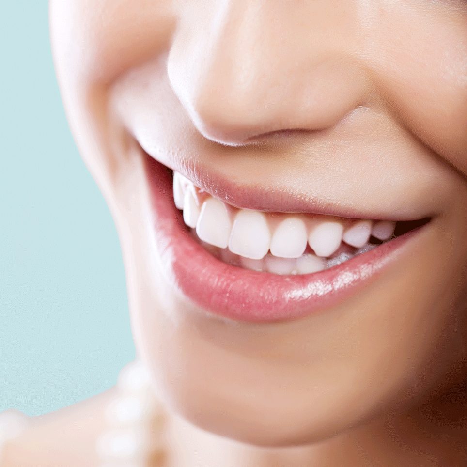 Stylsmile teeth whitener