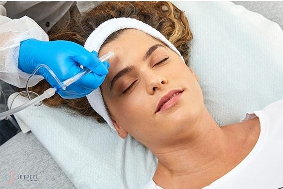 Jet Peel Facial