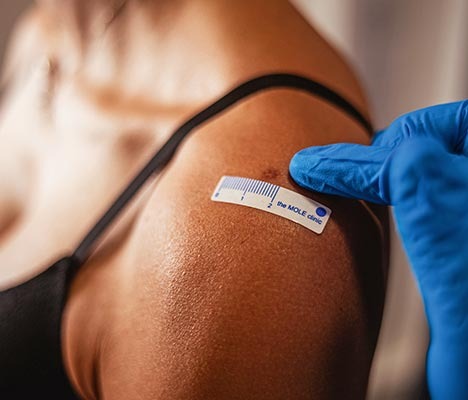 The Mole Clinic Review